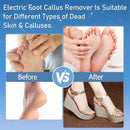 Electric Foot Callus Remover Waterproof，17 in1 Callus Remover for Feet - Black — 4