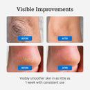 NUVADERMIS Urea Cream 40 Percent for Feet Maximum Strength, 5.3 oz — 7