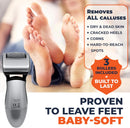 Own Harmony Electric Foot Callus Remover - Rechargeable Pedicure File Tool - Gray — 3