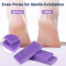 20 Small Pumice Stone for Feet - 3.6"x 1.8"x 0.5" Foot Pumice Stone - PU Pumice — 5