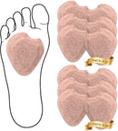 Felt Metatarsal Pads - Cushion for Morton's Neuroma & Plantar Fasciitis 1