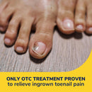 Dr. Scholl's Ingrown Toenail Pain Reliever, Medicated Gel Softens Nails for Easy Trimming, Foam Ring and Bandage Protect the Affected Area, Ingrown Toenail Treatment, White 0.3 Oz — 3