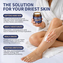 Veakoo Urea Cream 40 Percent for Feet Maximum Strength, Foot Cream with 2% Salicylic Acid, Dead Skin Cuticle Callus Remover, Urea Lotion for Intensive Repair of Dry Cracked Heels Hands — 3