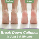 Callus Remover for Feet (Extra Strength 8 oz) Foot Callus Remover Gel — 4
