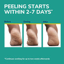 Dr. Scholl's Rough, Dry Skin Ultra Exfoliating Foot Peeling Mask, 3 Pairs — 4