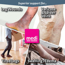 mediven plus for men & women, 20-30 mmHg, Compression Pantyhose, Closed Toe | Beige | II — 4