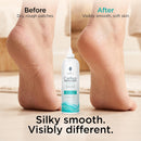 Lee Beauty 6oz Professional Gel Callus Remover for Feet - Unscented — 4