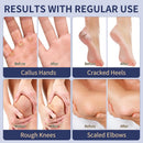 Veakoo Urea Cream 40 Percent for Feet Maximum Strength, Foot Cream with 2% Salicylic Acid, Dead Skin Cuticle Callus Remover, Urea Lotion for Intensive Repair of Dry Cracked Heels Hands — 4