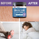 Magnum Solace Nighttime Magnesium Lotion with MSM & Arnica – Highly Concentrated Magnesium for Muscles & Joints – Apply to Legs or Feet Before Bed – Skin-Friendly — 2