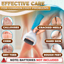Battery Operated Foot Callus Remover for Dead Skin, Exfoliating Tool - Ocean Blue Callus Remover — 8