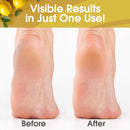DeEnti Callus Remover for Feet, Foot Callus Remover Gel, 8oz Lemon Scent — 3