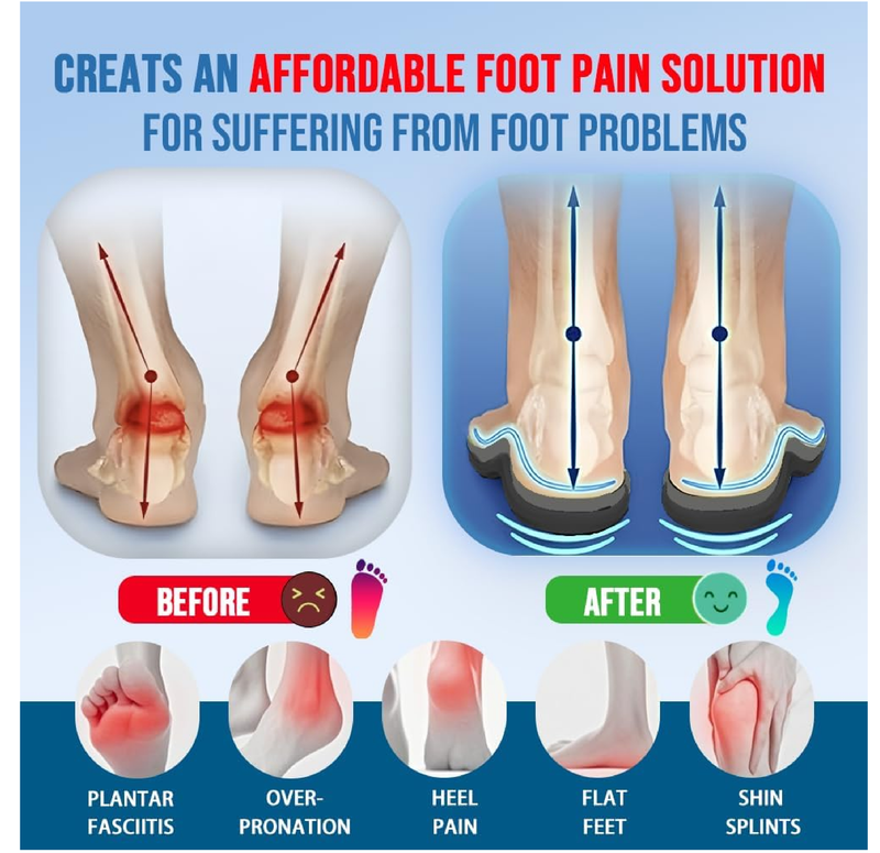 240lbs Plantar Fasciitis Relief Insoles Men Women, Comfort Metatarsal High Arch Support Shoe Inserts,