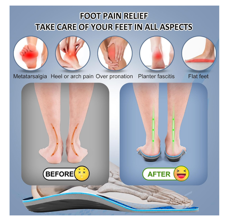 AOTENG STAR Plantar Fasciitis Insoles, High Arch Support Insoles from 240 to 300 lbs, Heavy Duty Orthotic Shoe Inserts for All Day Walking,