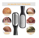 Foot File Callus Remover Colossal Foot Rasp and Professional Foot Scrubber Pedicure Kit to Remove Hard Skin for Wet and Dry Feet