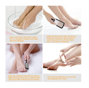 Foot File Callus Remover Colossal Foot Rasp and Professional Foot Scrubber Pedicure Kit to Remove Hard Skin for Wet and Dry Feet
