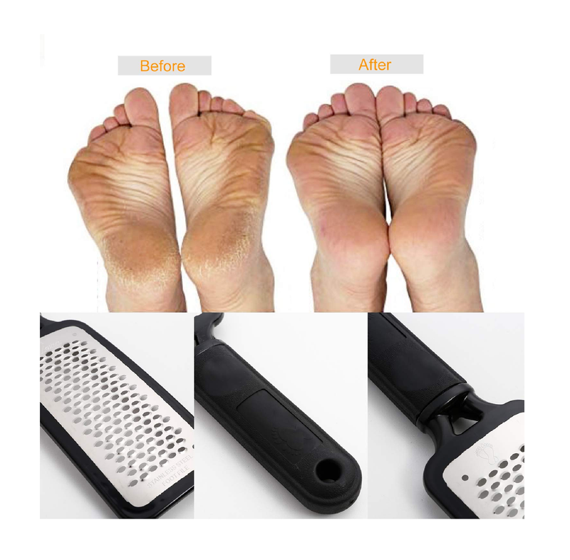 Stainless Steel Foot Scraper | Professional Double-Sided Foot File Callus  Remover for Feet | Foot Rasp Scrubber for Wet Or Dry Skin | Easy to Clean