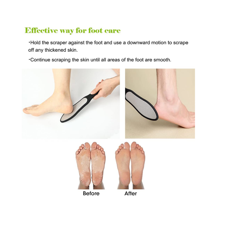 Foot Scrubber Foot Rasp And Callus Remover Foot File Professional Foot Care  Stainless Steel Foot Rasp - 1pcs style one black + 1pcs style one white 