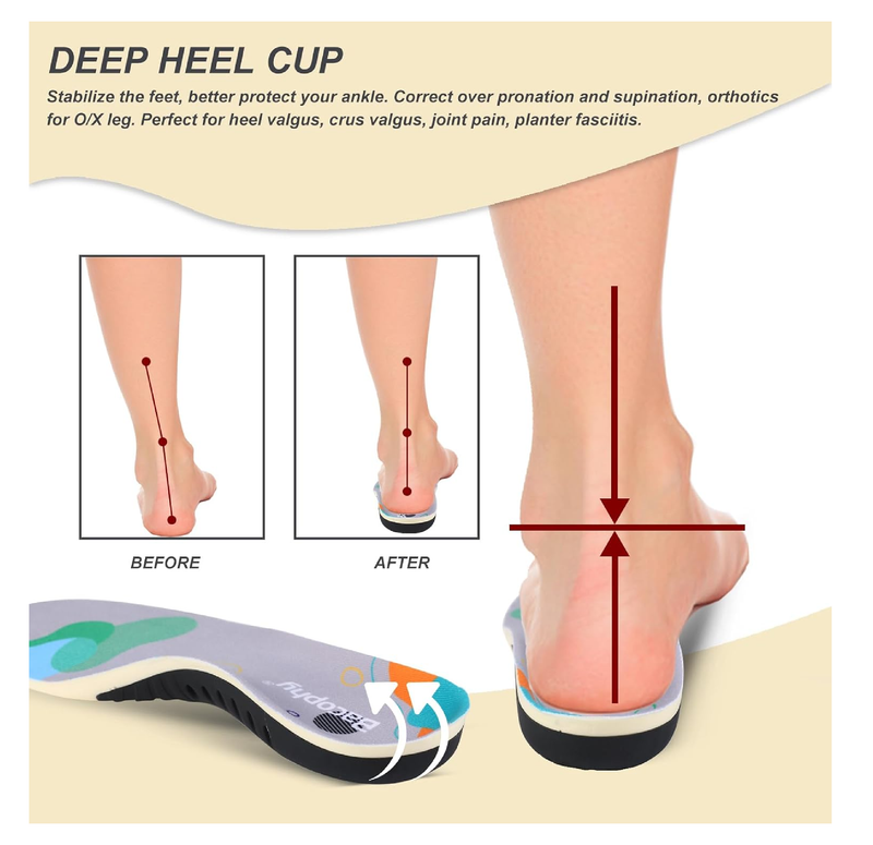 Bacophy Kids Arch Support Orthotic Insoles, Children Pu Cushioning Inserts,