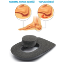 Orthopedic Heel Supports for Heel Pain Insoles