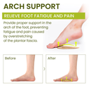 Arch Support Shoe Inserts & Insoles - Bukihome Gel Arch Inserts for Flat Feet, Plantar Fasciitis