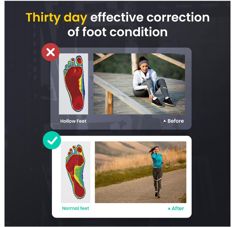 Bukihome Orthotic Arch Support Insoles for Plantar Fasciitis Relief & Heel Pain Shock Absorption Cushioned Inserts