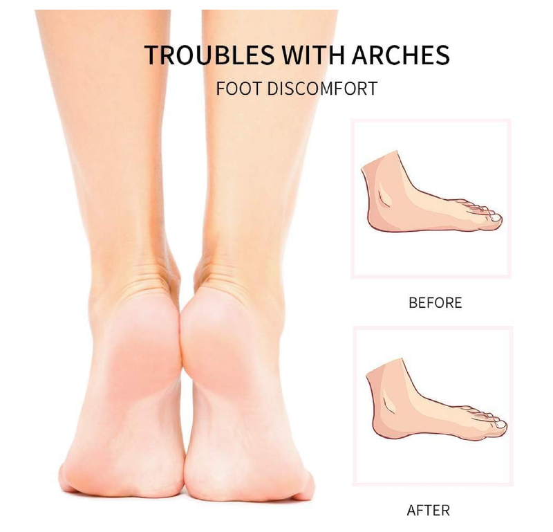 Correct Position Arch Support Shoe Insoles for Flat Feet, Gel Arch Inserts for Plantar Fasciitis,