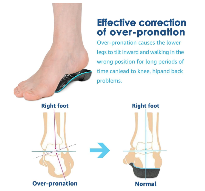 3/4 Plantar Fasciitis Insoles, High Arch Support Inserts for Flat Feet,