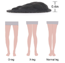 Dr. Foot's Supination & Over-Pronation Corrective Shoe Inserts, Medial & Lateral Heel Wedge Insoles for Foot Alignment,