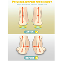 Arch Support Inserts for Women and Kids | Shoe Inserts for Women and Kids | Plantar Fasciitis Insoles