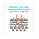 Callus Relief Stick with Powerful 30% Urea - Quick & Easy No-Mess Stick Helps Soften & Smooth Hard Thick Dry Cracked Rough Itchy Skin on Feet Legs Knees Elbows