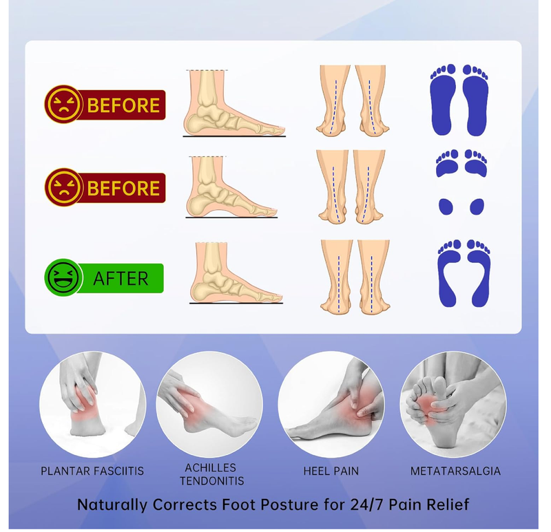 Plantar Fasciitis High Arch Support Insoles Men and Women Heavy Duty Support Pain Relief Orthotics for