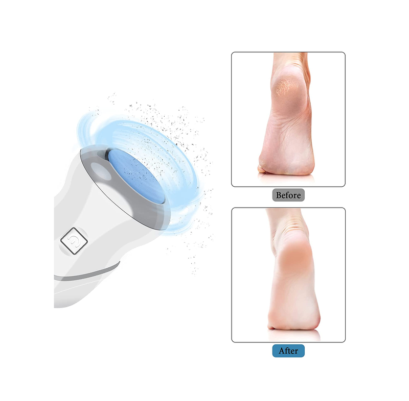 KVISTER Callus Remover for Feet Rechargeable Heel Scraper for Feet Electric Foot Callus Remover Dead Skin Remover for