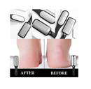 Oneleaf Professional pedicure kit Rasp Foot File Cracked Skin Corns Callus Remover for Extra Smooth and Beauty Foot with Bag