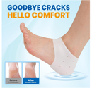 Pnrskter Silicone Heel Protectors for Women & Men – 2 Pairs Heel Cups for Cracked Heel Repair,