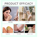 Foot Sanitizer Spray with Tea Tree Oil,Clear Foot Sanitizer Spray,Tea Tree Oil for Foot & Shoe Freshness (2PCS)