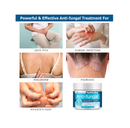 Roycederm Antifungal Cream Maximum Strength Antifungal Treatment for Athletes Foot Eczema Psoriasis Jock Itch Anti Itch Rash Ringworm Treatment for Humans and Skin Yeast Infection