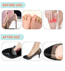 UamGlsob 3 Pairs Shoe Filler Inserts, Toe Cushion Inserts That Make Shoes Fit,