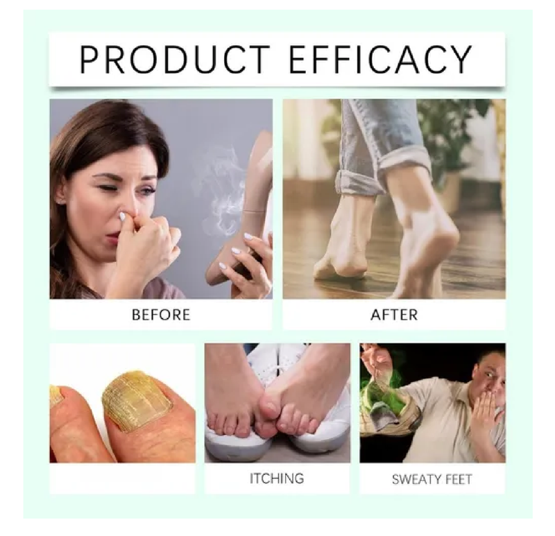 2PCS Foot Spray with Tea Tree Oil,Tea Tree Oil Feet Spray,Foot & Shoe Freshness,Quick-Drying and Travel-Friendly