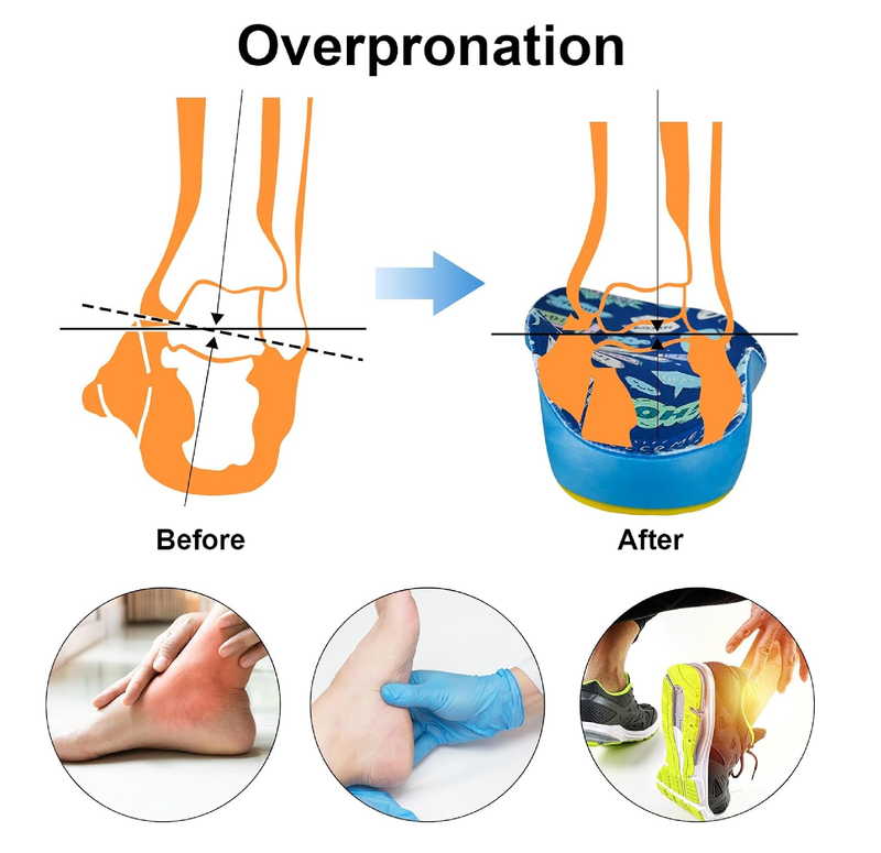 Kids Insoles for Over-Pronation Soft PU Foam Orthotics Relieve Plantar Fasciitis Flat Foot Child Inserts Gel Heel Cushion