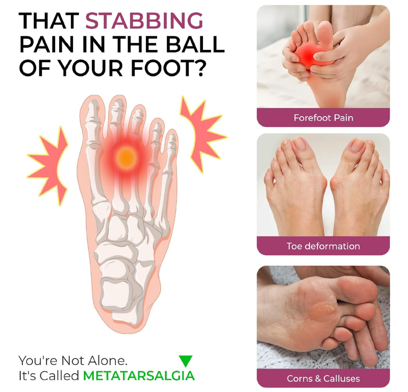 Welnove Metatarsal Pads for Women Men - Drip-Shape - Leather Ball-of-Foot Cushions for Forefoot Support