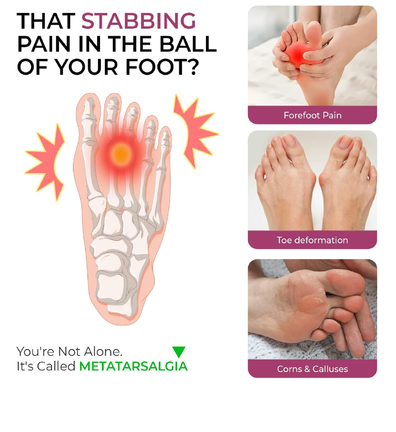 Welnove Metatarsal Pads for Women Men - 4 Pairs Leather Ball-of-Foot Cushions for Forefoot Support