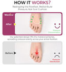 Welnove Metatarsal Pads for Women Men - 4 Pairs Leather Ball-of-Foot Cushions for Forefoot Support