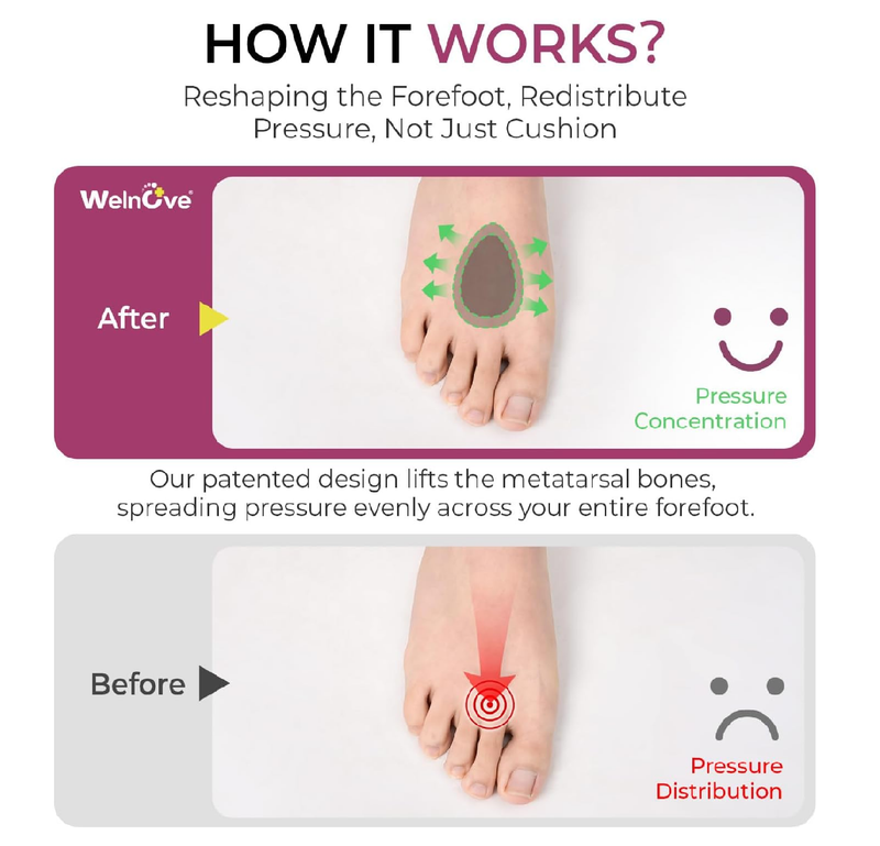Welnove Metatarsal Pads for Women Men - Drip-Shape - Leather Ball-of-Foot Cushions for Forefoot Support