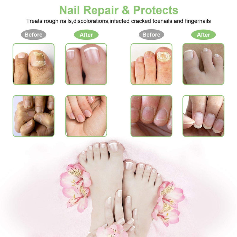 NailRepairPen4PackToenailTreatmentToenailCare6.jpg