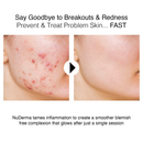 NuDerma Portable Handheld High Frequency Skin Therapy Wand Machine w/Neon